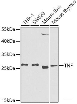 Immunofluorescence analysis of Jurkat cells using MyD88 Polyclonal Antibody at dilution of  1:100 (40x lens). Blue: DAPI for nuclear staining.