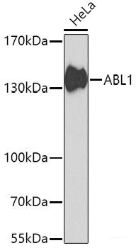 Immunohistochemistry of paraffin-embedded Human colon using MSH6 Polyclonal Antibody at dilution of  1:100 (40x lens).