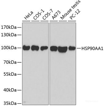 Immunohistochemistry of paraffin-embedded Mouse lung using MUC16 Polyclonal Antibody at dilution of  1:100 (40x lens).