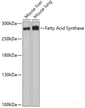 Immunofluorescence analysis of HeLa cells using CYP3A7 Polyclonal Antibody at dilution of  1:100 (40x lens). Blue: DAPI for nuclear staining.