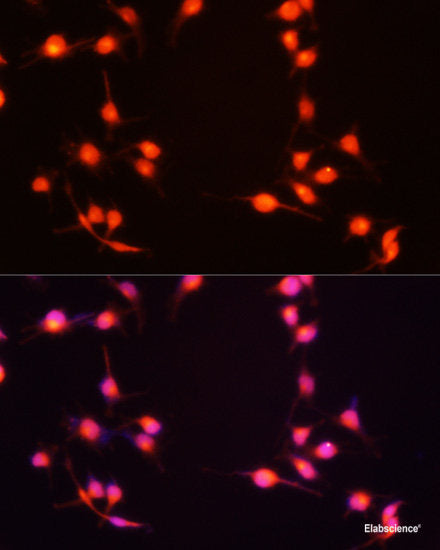 Immunofluorescence analysis of Mouse oophoroma cells using ZP2 Polyclonal Antibody at dilution of  1:100. Blue: DAPI for nuclear staining.