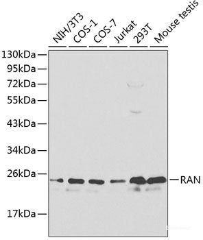 Immunohistochemistry of paraffin-embedded Human prostate using RAD23B Polyclonal Antibody at dilution of  1:100 (40x lens).