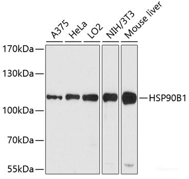 Immunohistochemistry of paraffin-embedded Human liver using KLHL42 Polyclonal Antibody at dilution of  1:100 (40x lens).