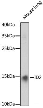 Immunohistochemistry of paraffin-embedded Human mammary cancer using MTHFD2 Polyclonal Antibody at dilution of  1:100 (40x lens).