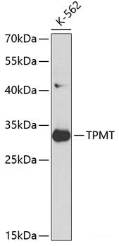 Immunohistochemistry of paraffin-embedded Human oophoroma using MCM3 Polyclonal Antibody at dilution of  1:100 (40x lens).