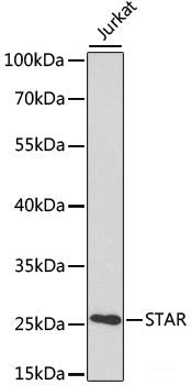 Immunohistochemistry of paraffin-embedded Rat heart using CTGF Polyclonal Antibody at dilution of  1:100 (40x lens).