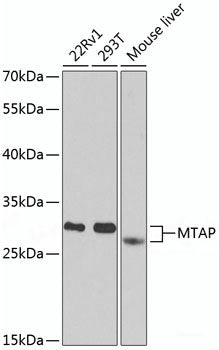 Immunohistochemistry of paraffin-embedded Rat brain using PPAR gamma Polyclonal Antibody at dilution of  1:100 (40x lens).