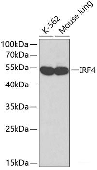 Immunohistochemistry of paraffin-embedded Rat liver using SQSTM1 / p62 Polyclonal Antibody at dilution of  1:200 (40x lens).