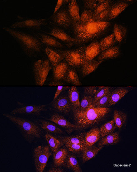 Immunohistochemistry of paraffin-embedded Rat testis using Bcl-2 Polyclonal Antibody at dilution of  1:200 (40x lens).