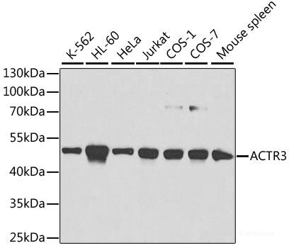 Immunohistochemistry of paraffin-embedded Human colon using CTCF Polyclonal Antibody at dilution of  1:100 (40x lens).