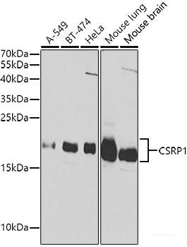 Immunohistochemistry of paraffin-embedded Rat ovary using mTOR Polyclonal Antibody at dilution of  1:150 (40x lens).