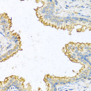 Immunofluorescence analysis of THP-1 cells using IL1 beta Polyclonal Antibody at dilution of  1:100. Blue: DAPI for nuclear staining.