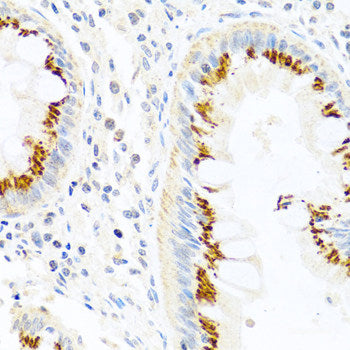 Immunohistochemistry of paraffin-embedded Human liver using ATG5 Polyclonal Antibody at dilution of  1:100 (40x lens).