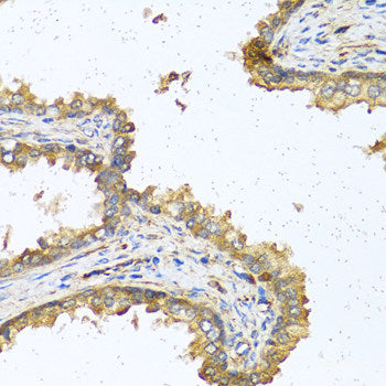 Immunofluorescence analysis of HeLa cells using LAMP1 Polyclonal Antibody at dilution of  1:100. Blue: DAPI for nuclear staining.