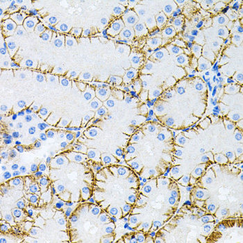 Immunohistochemistry of paraffin-embedded Rat testis using Histone H2AX Polyclonal Antibody at dilution of  1:100 (40x lens).
