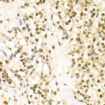 Immunohistochemistry of paraffin-embedded Human lung using TPM1 Polyclonal Antibody at dilution of  1:100 (40x lens).