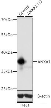 Immunofluorescence analysis of Hela cells using CHAMP1 Polyclonal Antibody at dilution of  1:100 (40x lens). Blue: DAPI for nuclear staining.