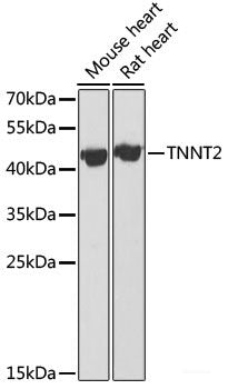 Immunofluorescence analysis of Rat pancreas using SERPINI2 Polyclonal Antibody at dilution of  1:100 (40x lens). Blue: DAPI for nuclear staining.