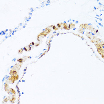 Immunohistochemistry of paraffin-embedded Human liver using NQO2 Polyclonal Antibody at dilution of  1:100 (40x lens).