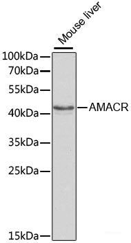 Immunohistochemistry of paraffin-embedded Human breast using TGFBR2 Polyclonal Antibody at dilution of  1:100 (40x lens).
