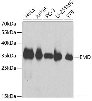 Immunohistochemistry of paraffin-embedded Mouse heart using NOXA2 / P67phox Polyclonal Antibody at dilution of  1:100 (40x lens).