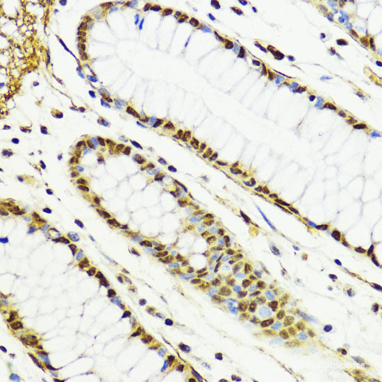 Immunofluorescence analysis of 293T cells using FXN / FRataxin Polyclonal Antibody at dilution of  1:100 (40x lens). Blue: DAPI for nuclear staining.