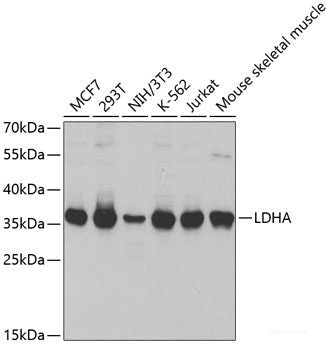 Immunohistochemistry of paraffin-embedded Human colon carcinoma using NOX1 Polyclonal Antibody at dilution of  1:100 (40x lens).