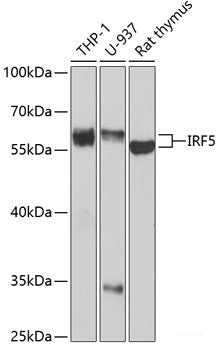 Immunohistochemistry of paraffin-embedded Human breast cancer using ABCC5 Polyclonal Antibody at dilution of  1:100 (40x lens).