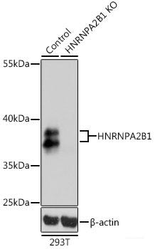 Immunofluorescence analysis of C6 cells using CTSL Polyclonal Antibody at dilution of  1:100. Blue: DAPI for nuclear staining.