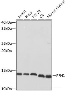 Immunofluorescence analysis of C6 cells using RAB21 Polyclonal Antibody at dilution of  1:100. Blue: DAPI for nuclear staining.