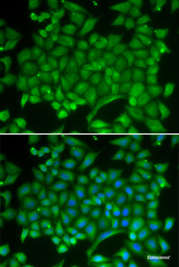 Immunohistochemistry of paraffin-embedded Rat brain using UGDH Polyclonal Antibody at dilution of  1:100 (40x lens).