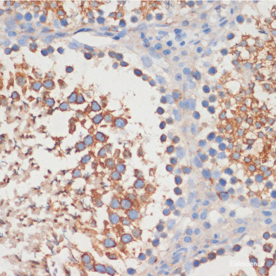 Immunohistochemistry of paraffin-embedded Human placenta using SARS2 Polyclonal Antibody at dilution of  1:100 (40x lens).