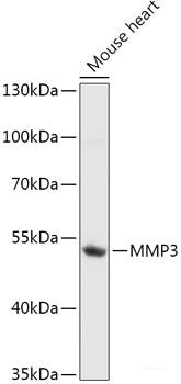 Immunohistochemistry of paraffin-embedded Rat spleen using CD3D Polyclonal Antibody at dilution of  1:200 (40x lens).