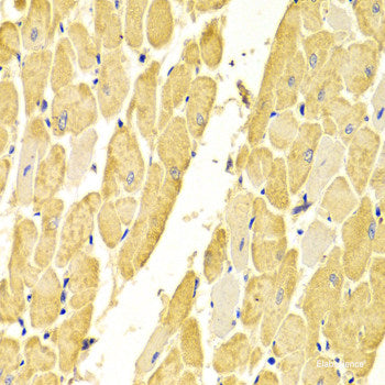 Immunohistochemistry of paraffin-embedded Human mammary cancer using NOD1 Polyclonal Antibody at dilution of  1:100 (40x lens).