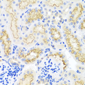 Immunohistochemistry of paraffin-embedded Human prostate using PTHLH Polyclonal Antibody at dilution of  1:100 (40x lens).