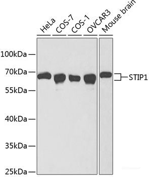 Immunohistochemistry of paraffin-embedded Rat kidney using SURF1 Polyclonal Antibody at dilution of  1:100 (40x lens).