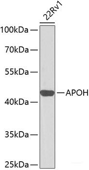 Western blot analysis of extracts of various cell lines using TRPC1 Polyclonal Antibody at dilution of 1:1000.