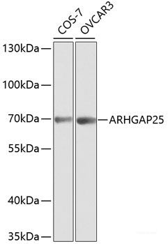 Immunohistochemistry of paraffin-embedded Human prostate using VEGFC Polyclonal Antibody at dilution of  1:100 (40x lens).