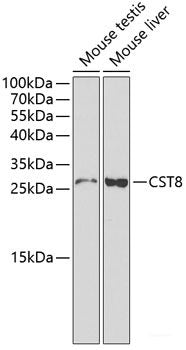 Immunohistochemistry of paraffin-embedded Human mammary cancer using SLC30A1 Polyclonal Antibody at dilution of  1:100 (40x lens).