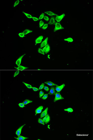 Immunofluorescence analysis of Mouse intestine using TRPA1 Polyclonal Antibody at dilution of  1:100. Blue: DAPI for nuclear staining.