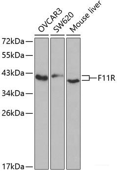 Immunohistochemistry of paraffin-embedded Rat lung using NLRP3 Polyclonal Antibody at dilution of  1:100 (40x lens).