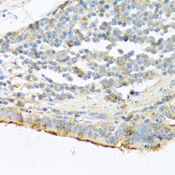 Immunohistochemistry of paraffin-embedded Rat kidney using ACSL5 Polyclonal Antibody at dilution of  1:100 (40x lens).