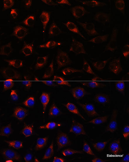 Immunohistochemistry of paraffin-embedded Mouse pancreas using EDN3 Polyclonal Antibody at dilution of  1:100 (40x lens).