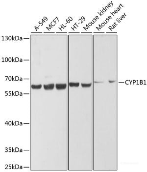 Immunohistochemistry of paraffin-embedded Human kidney cancer using STMN1 Polyclonal Antibody at dilution of  1:200 (40x lens).