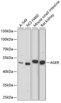 Immunohistochemistry of paraffin-embedded Rat kidney using EPHX2 Polyclonal Antibody at dilution of  1:200 (40x lens).