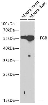 Immunofluorescence analysis of C6 cells using CBS Polyclonal Antibody at dilution of  1:100. Blue: DAPI for nuclear staining.