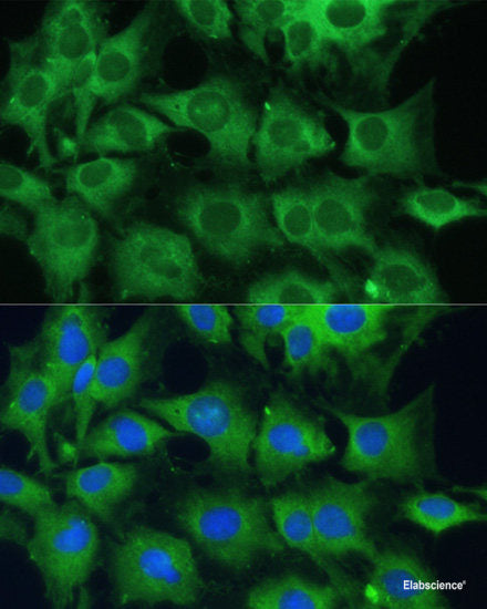 Immunofluorescence analysis of L929 cells using RHBDD1 Polyclonal Antibody at dilution of  1:100 (40x lens). Blue: DAPI for nuclear staining.