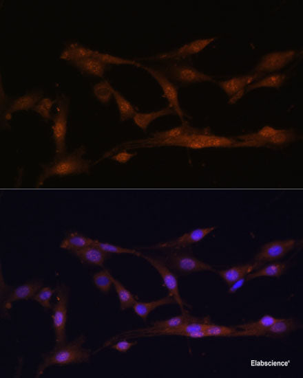 Immunohistochemistry of paraffin-embedded Human colon carcinoma using HIGD1A Polyclonal Antibody at dilution of  1:100 (40x lens).
