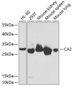 Immunofluorescence analysis of HCT116 cells using KDM7A Polyclonal Antibody at dilution of  1:150. Blue: DAPI for nuclear staining.
