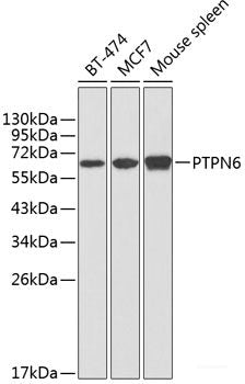 Immunofluorescence analysis of Rat brain using HCRTR1 Polyclonal Antibody at dilution of  1:100. Blue: DAPI for nuclear staining.